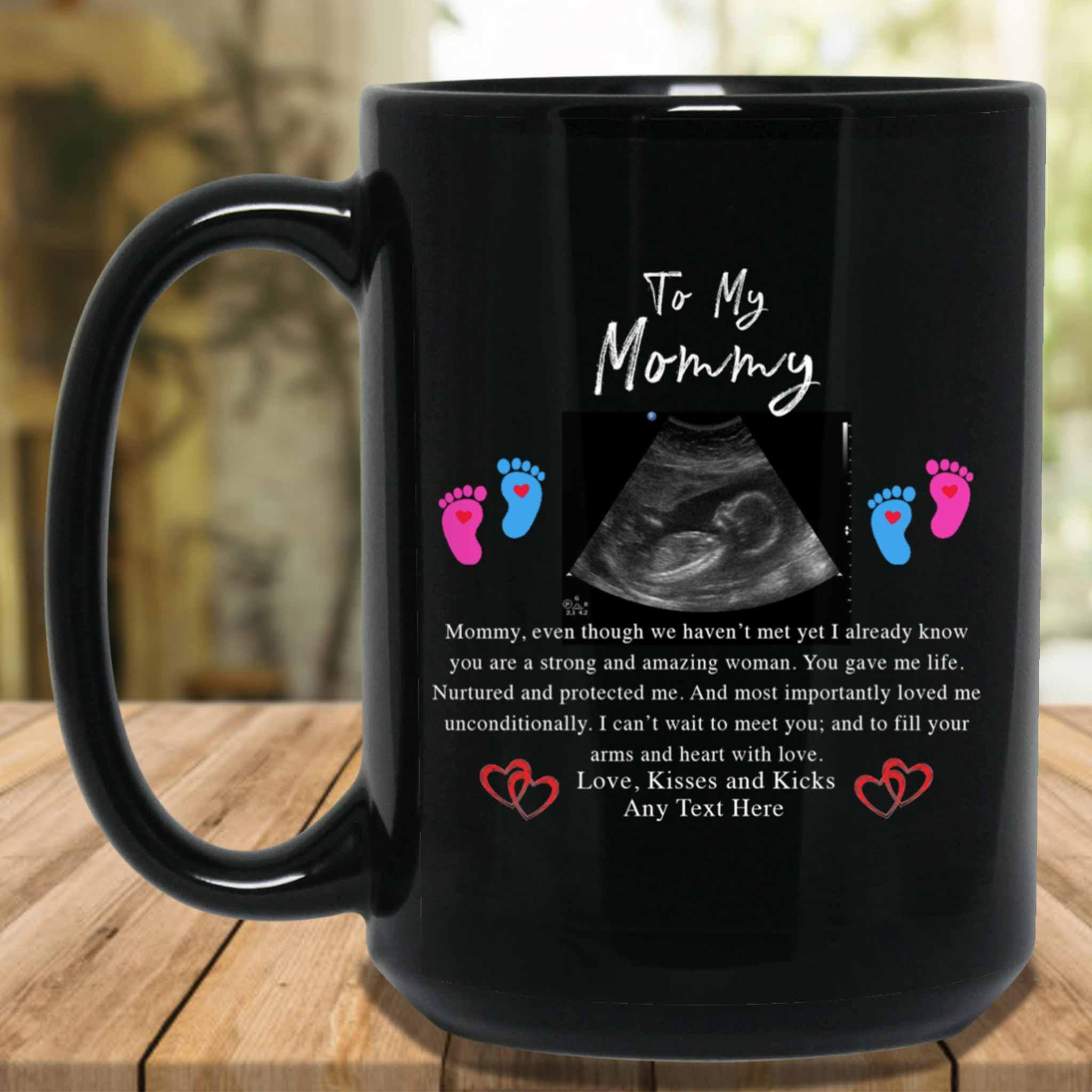 To My Mommy v1 Personalized Sonogram Image And From Text New Mom To Be Black Coffee MugsCustomly Gifts