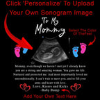 To My Mommy v1 Personalized Sonogram Image And From Text New Mom To Be Black Coffee MugsCustomly Gifts
