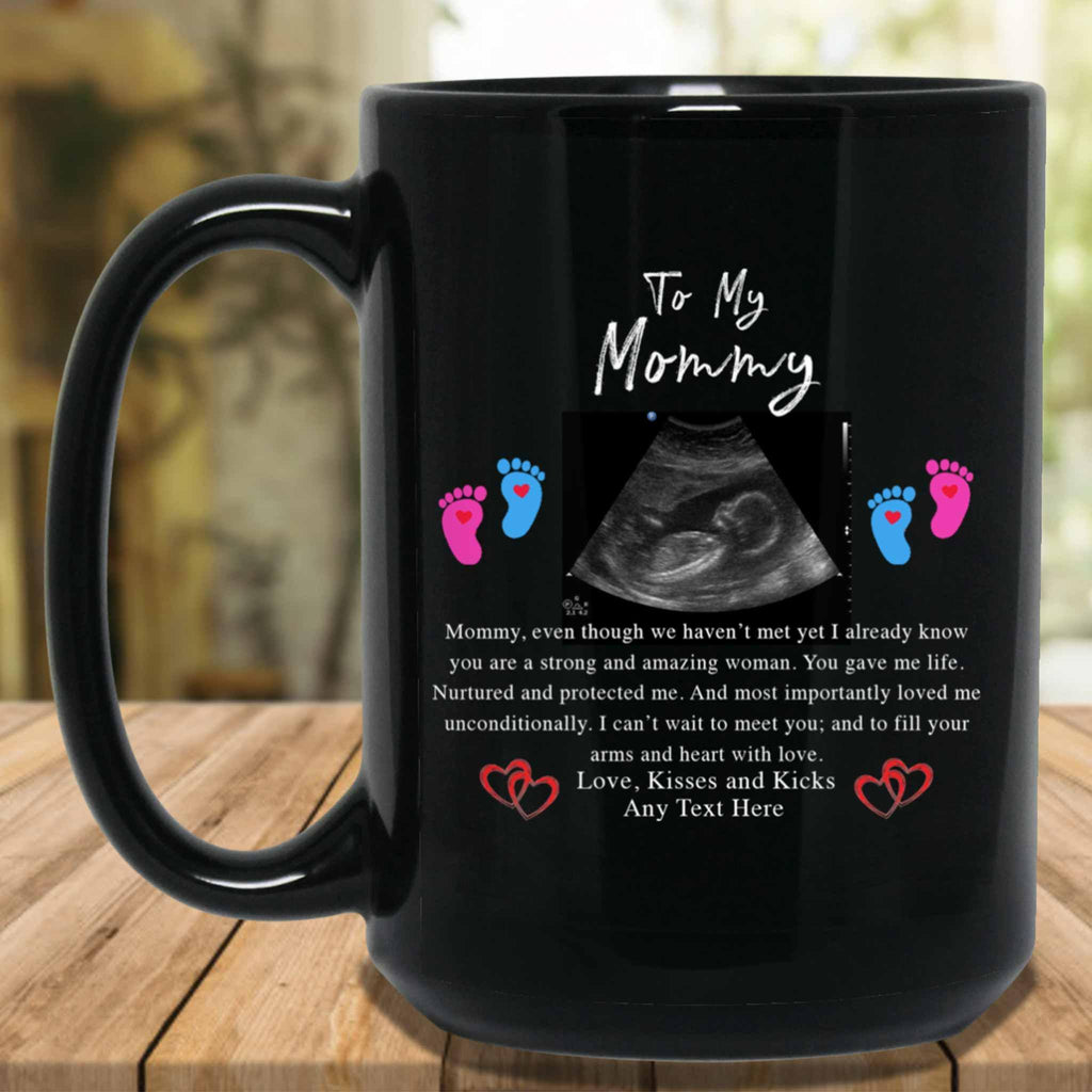 To My Mommy v1 Personalized Sonogram Image And From Text New Mom To Be Black Coffee MugsCustomly Gifts