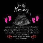 To My Mommy v1 Pillow With Personalized Sonogram Image And From TextCustomly Gifts