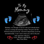 To My Mommy v1 Pillow With Personalized Sonogram Image And From TextCustomly Gifts